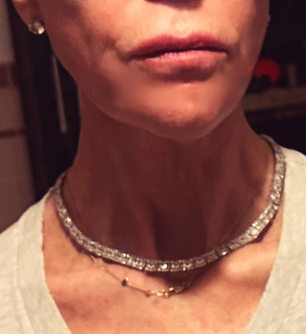 Dorsey Lilia Lace Collar Necklace 15” New